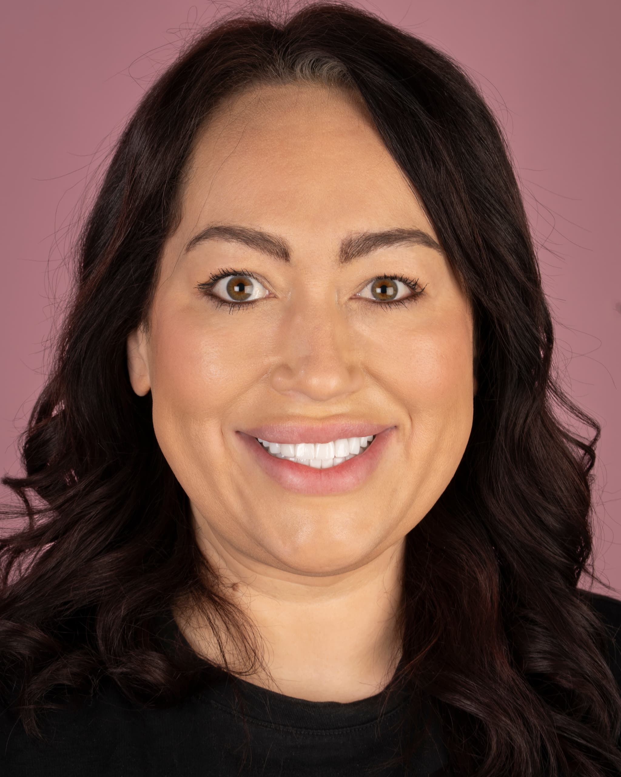 Birleşik Krallık - Smile Design, 24x Zirconia Crowns