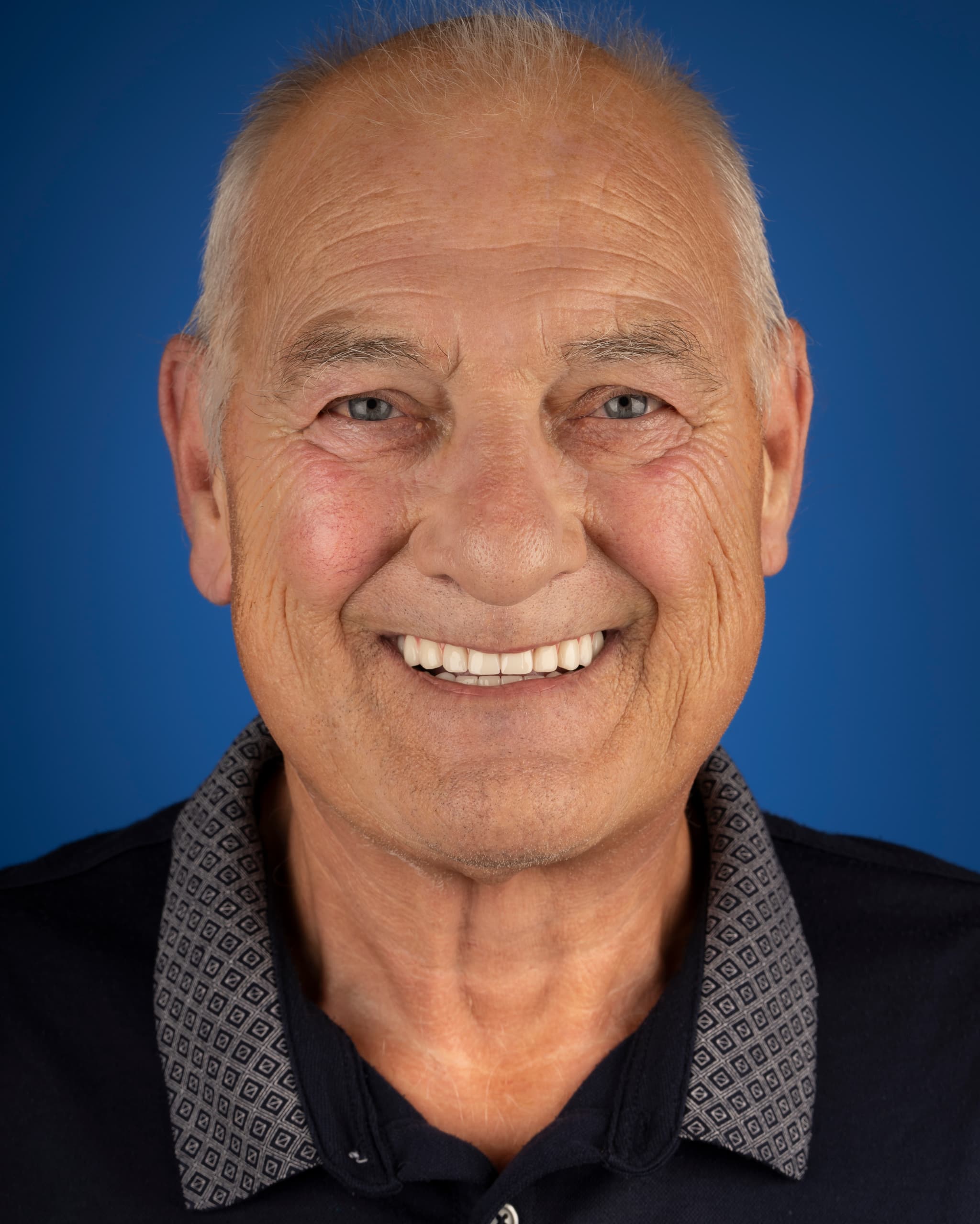 Birleşik Krallık - Smile Design, 24x Zirconia Crowns