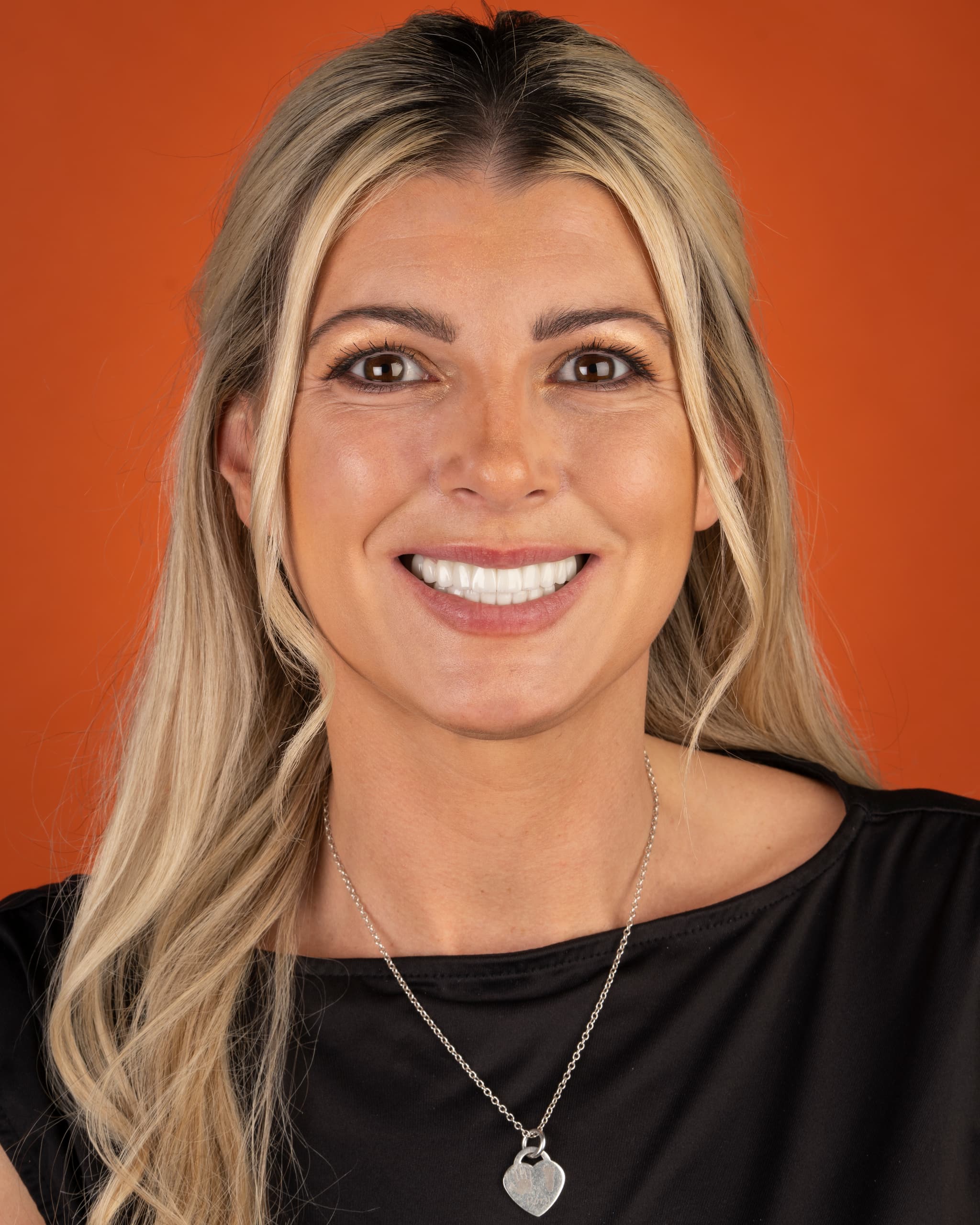 Birleşik Krallık - Smile Design, 24x Zirconia Crowns