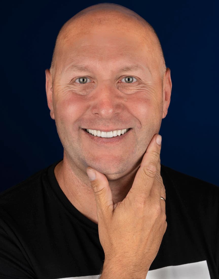 ALL ON FOUR IMPLANT SYSTEM