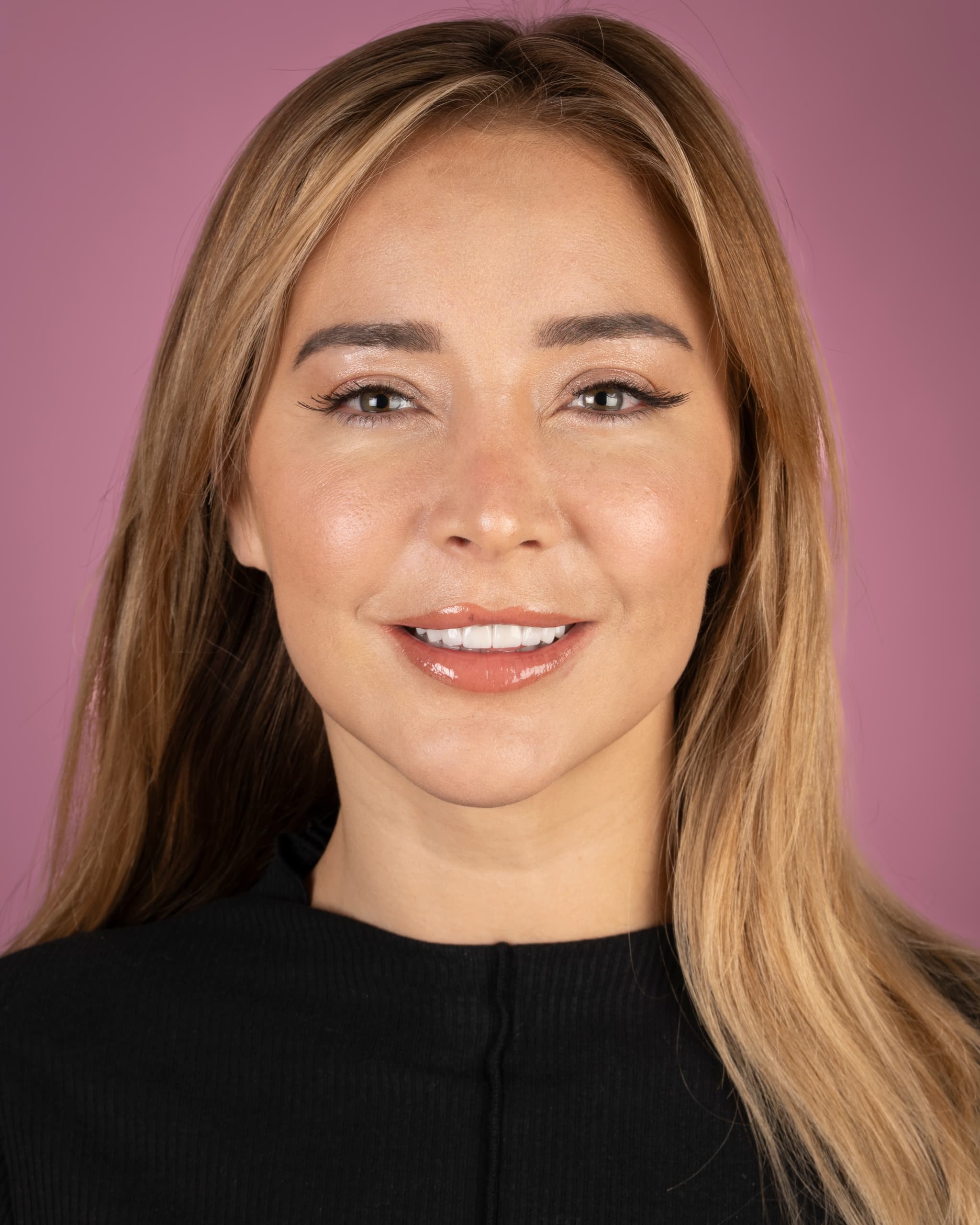 Birleşik Krallık - Smile Design, 20x E.max Veneers