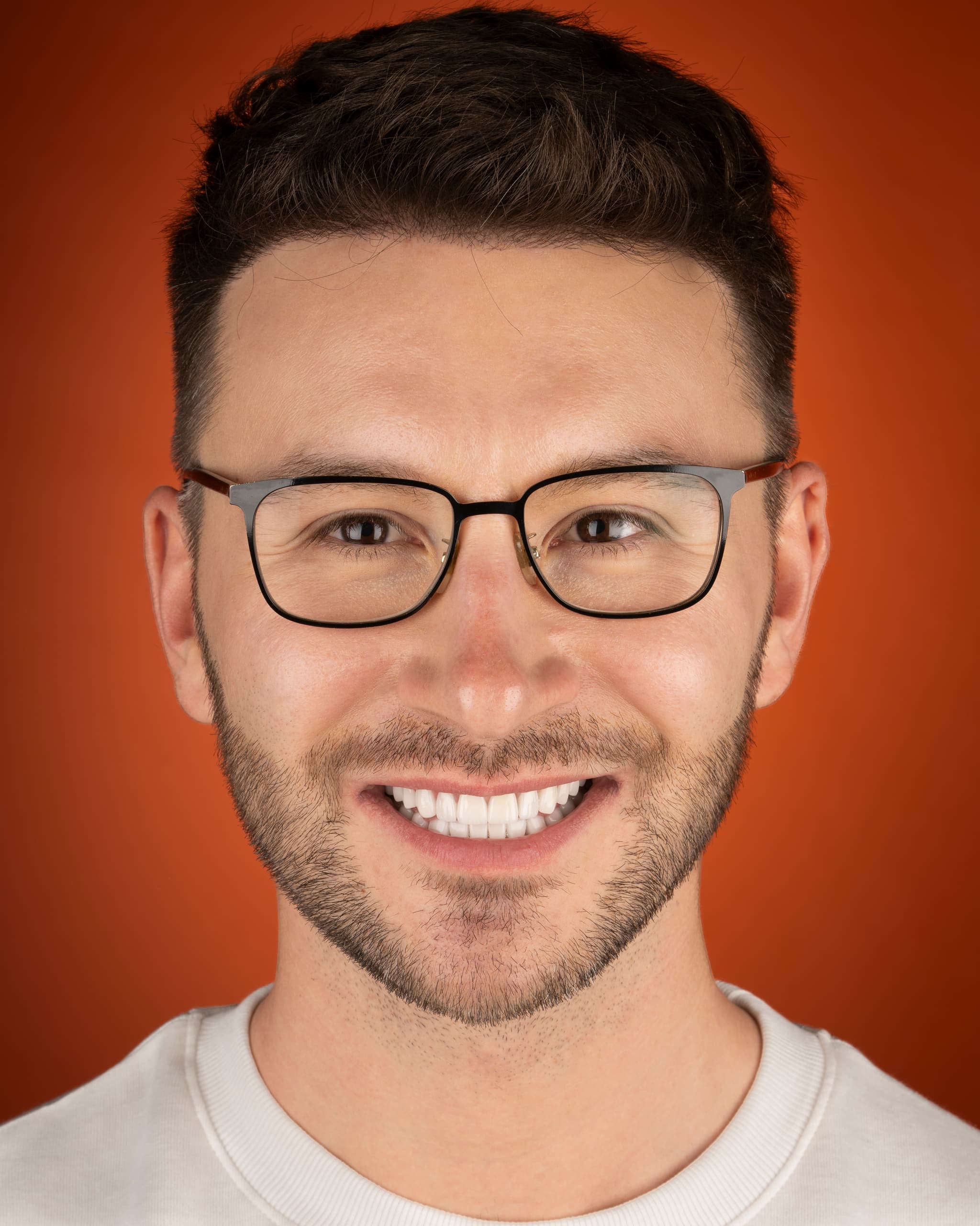 Poland - Smile Design, 6x E.max Crowns