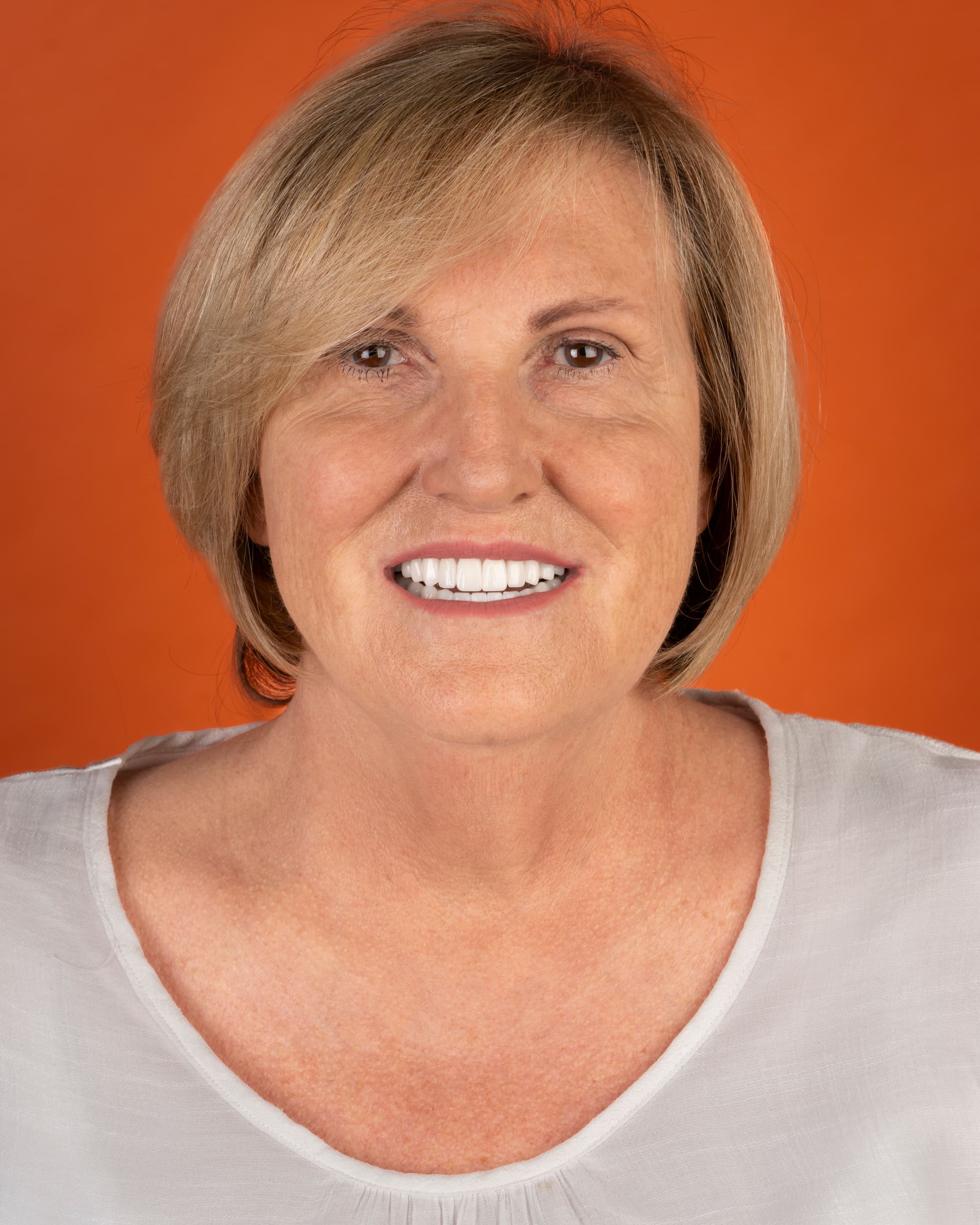 UK - Smile Design, 26x Zirconia Crowns