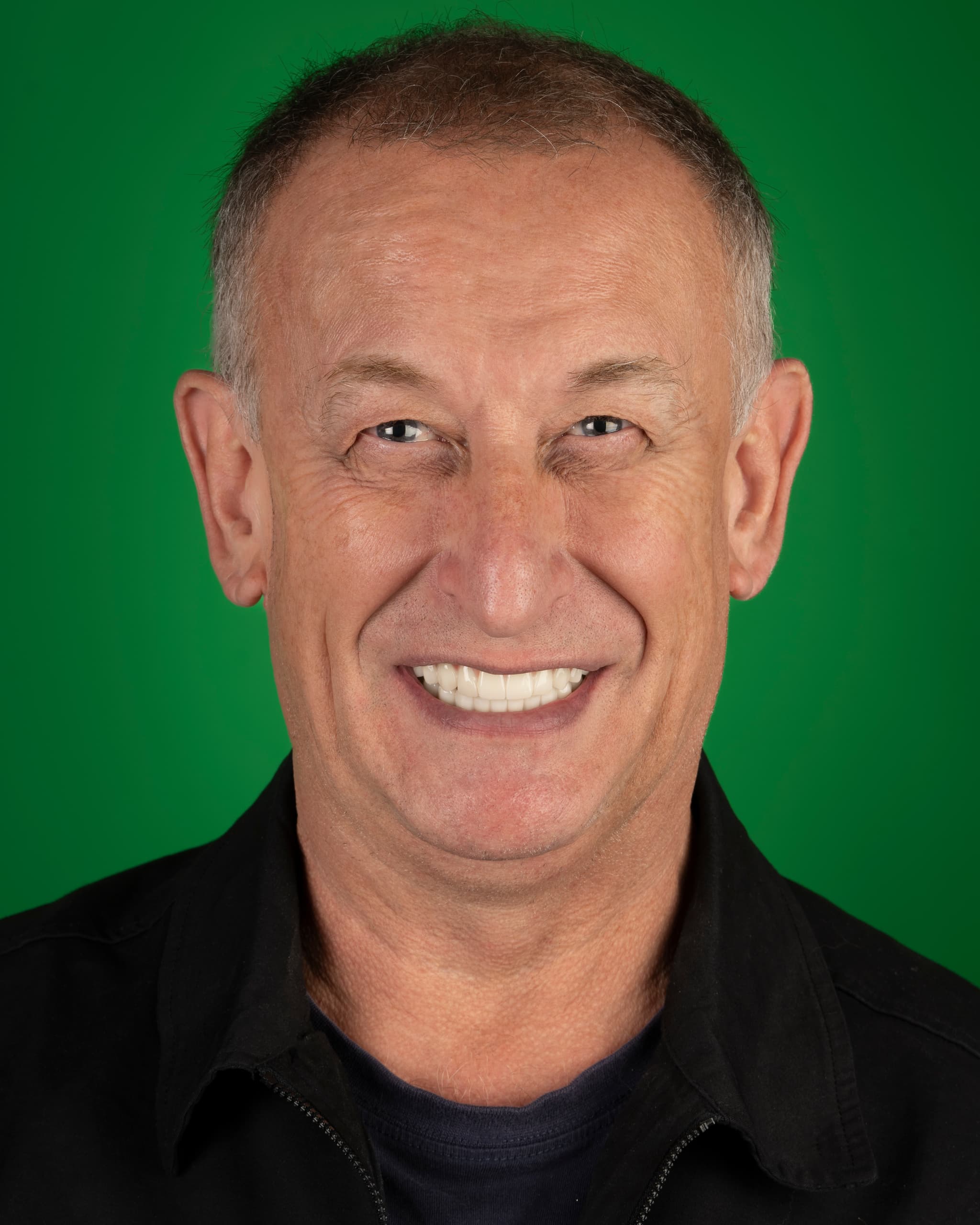 UK - Smile Design, 24x Zirconia Crowns