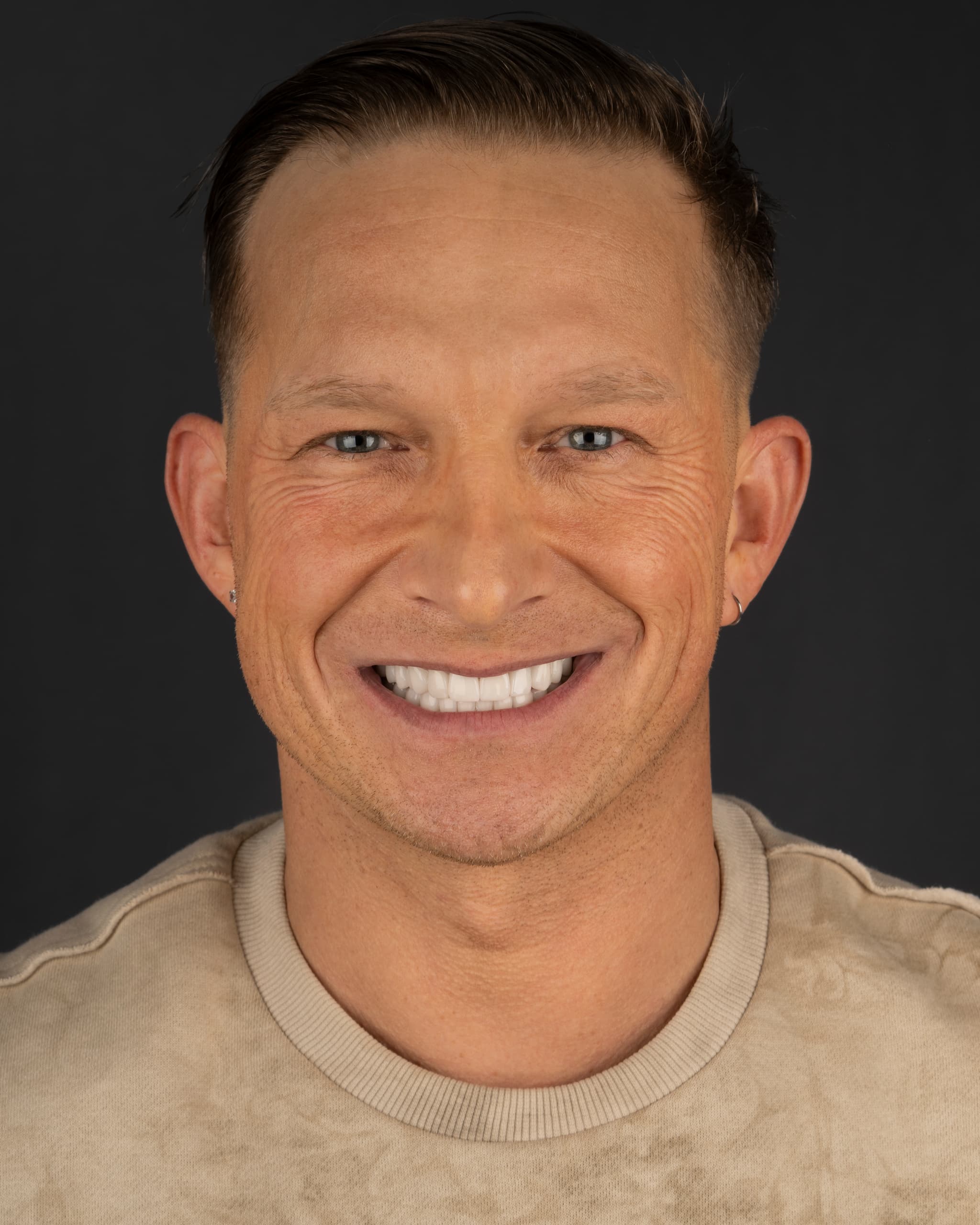 Poland - Smile Design, 24x Zirconia Crowns