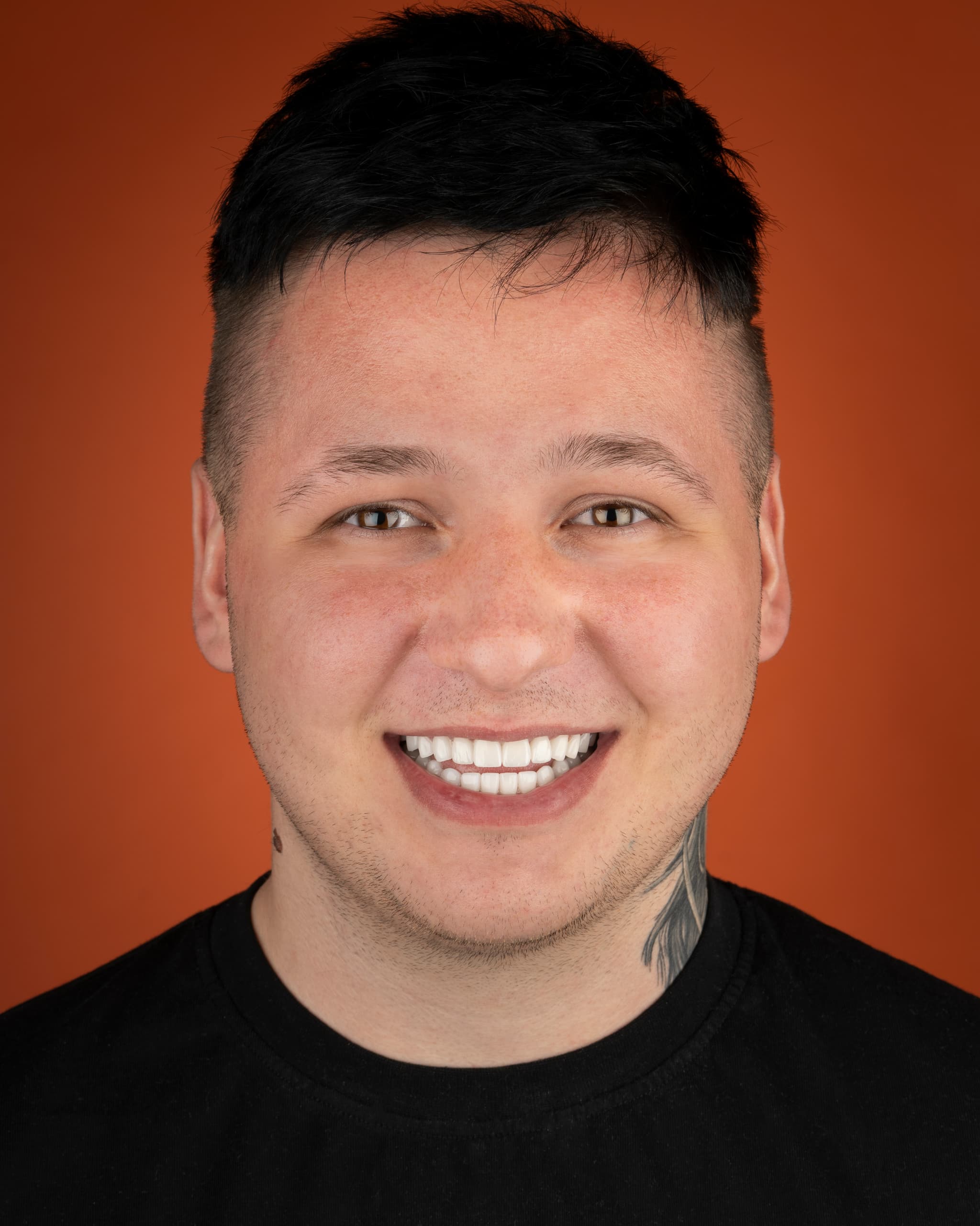 Poland - Smile Design, 28x Zirconia Crowns