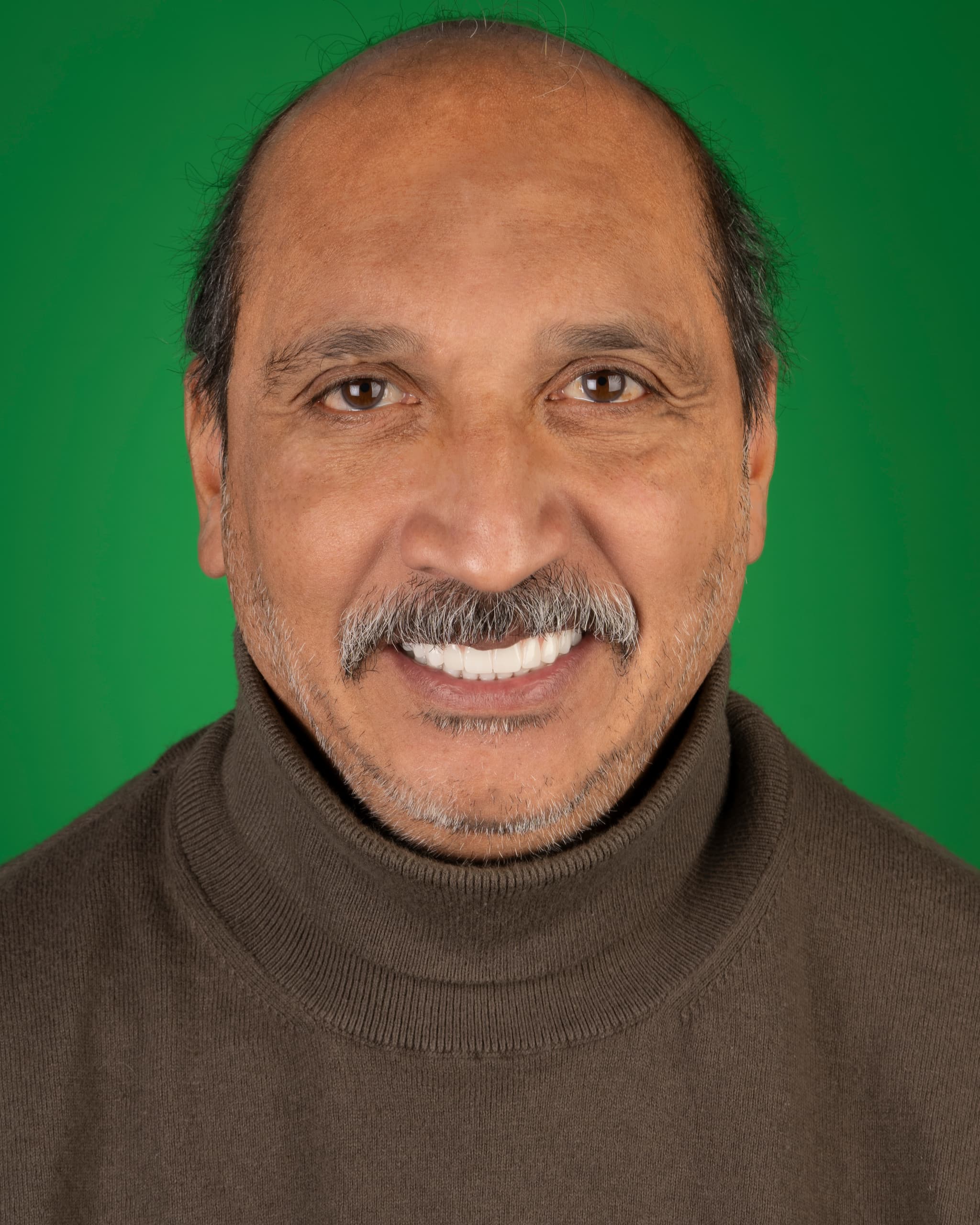 UK - Smile Design, 24x Zirconia Crowns